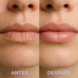Lip Repair - ILHŨ CARE