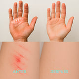 Skin Repair