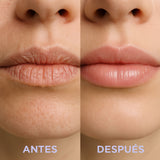 Lip Repair